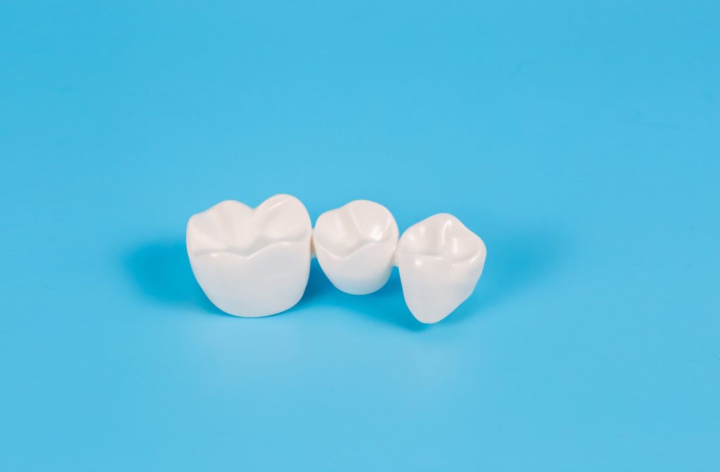 Three plastic veneers sitting on a blue background surface.